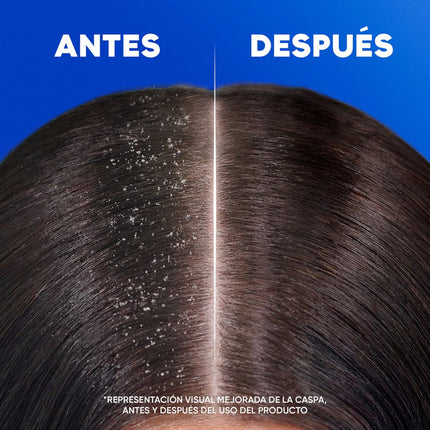 H&S Apple Fresh Champú anticaspa 0% parabenos fosfatos parafinas 250 ml